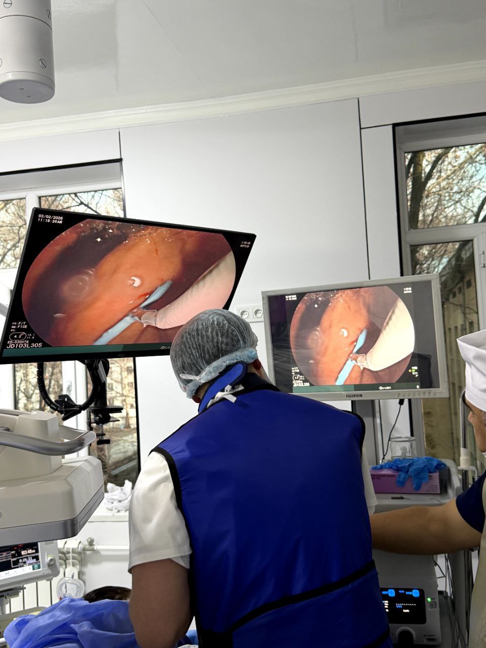 Уникальная операция без разрезов: медицинский прорыв в Таджикистане